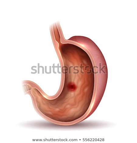 Сток-фото: Stomach Ulcer Interanl Organs Anatomy Colorful Drawing