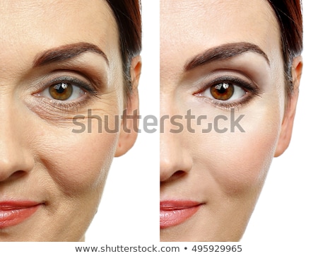 Stockfoto: Womans Nose Before And After Plastic Surgery