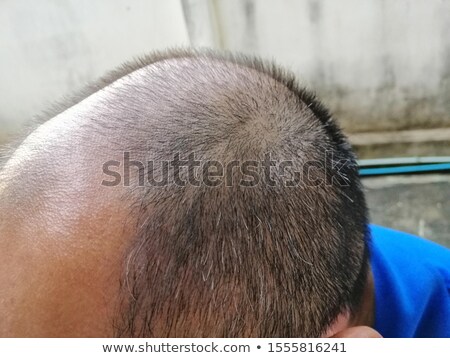 Foto stock: Mature Man Having A Scalp Massage