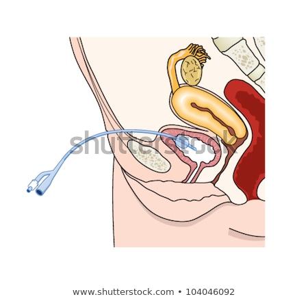 Foley Catheter Stock foto © Blamb