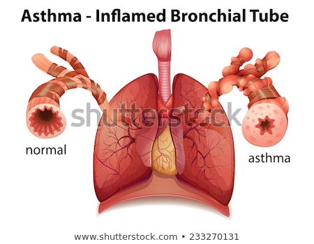 Zdjęcia stock: Asthma Bronchial Tube