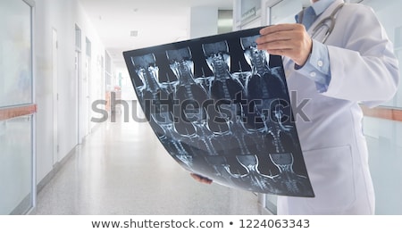 Stok fotoğraf: Doctor Looking At Neck Mri