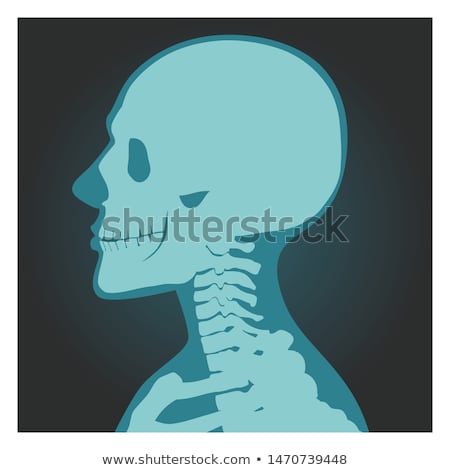 X Ray Shot Of Skull Human Body Head And Neck Bones Side View Radiography Vector Illustration Zdjęcia stock © MarySan