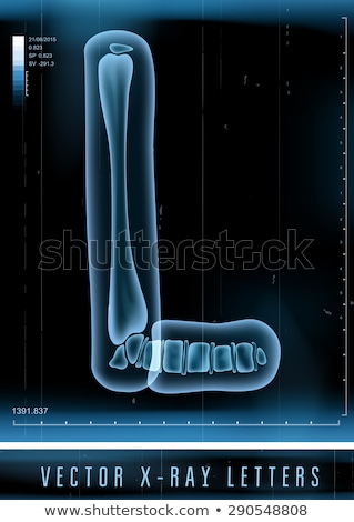 Stockfoto: Transparent X Ray Letter L 3d