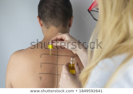 Stock fotó: Doctor Performing A Skin Prick Test