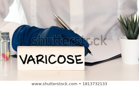 Stockfoto: Varicosity Diagnosis Medical Concept