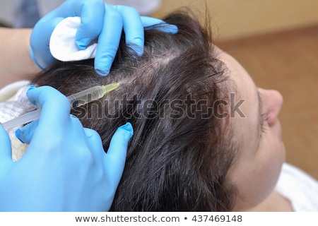 Stok fotoğraf: Anti Hair Loss Injection In Clinic