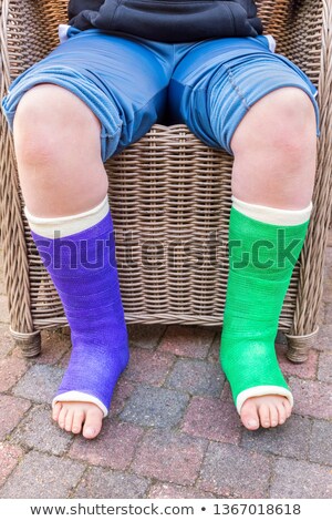 Stock fotó: Sitting Boy With Two Colored Gypsum Legs
