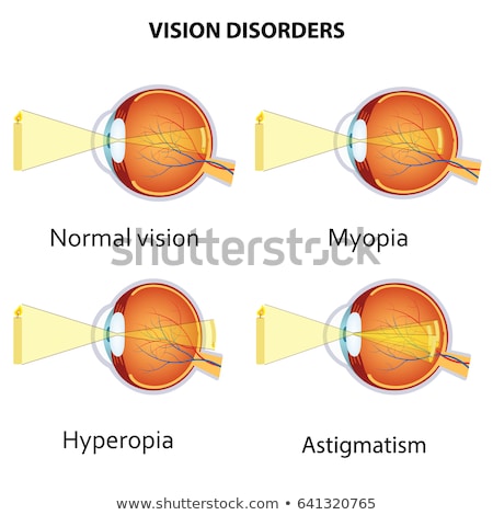 Astigmatism Myopia And Hyperopia Foto d'archivio © Neokryuger