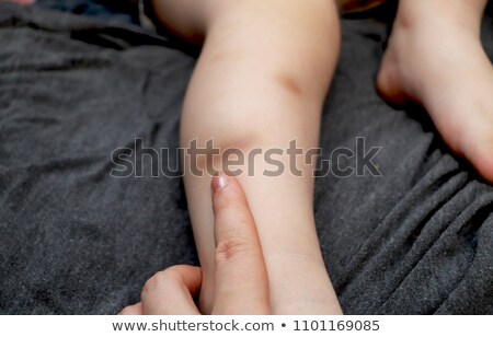 [[stock_photo]]: Doctor Helping Boy With Bruise