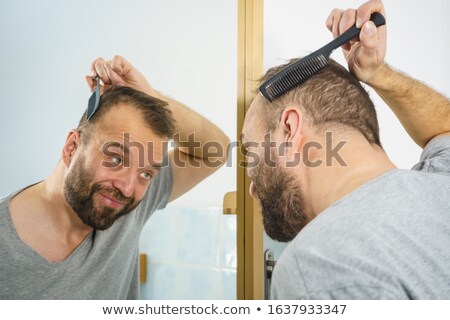 Stock photo: Receding Hairlines