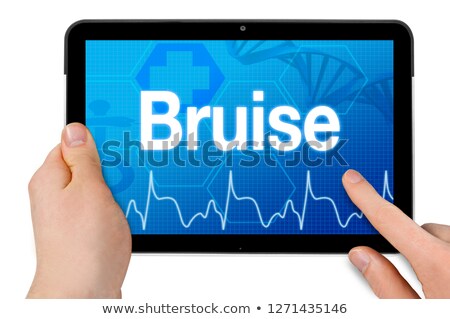 Foto d'archivio: Tablet With The Diagnosis Bruise On The Display