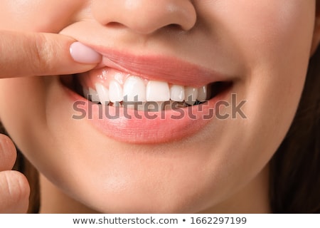 ストックフォト: Tooth In Gum