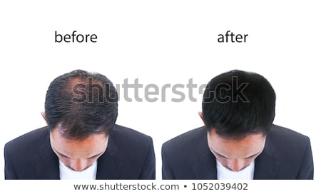 Foto stock: Old Bald Businessman