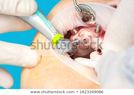 Zdjęcia stock: Instrument For Dental Implantology