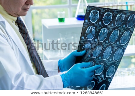 [[stock_photo]]: Male Surgeon Holding Brain