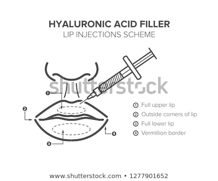 Foto stock: Before And After Hyaluronic Acid Lips Injection