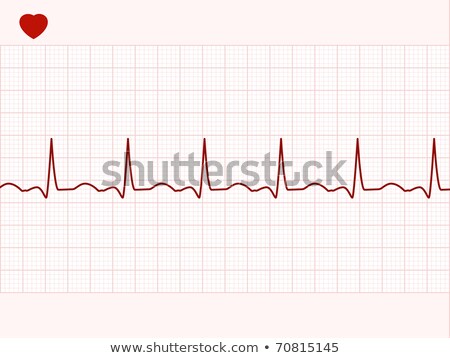 Foto stock: Normal Electronic Cardiogram Eps 8