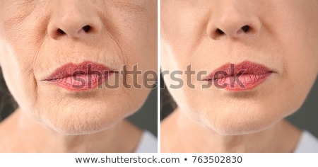 Stok fotoğraf: Before And After Beauty Treatment