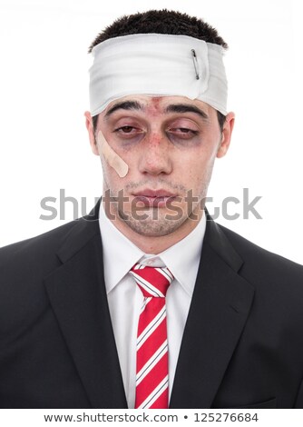 Stock fotó: Badly Beaten Businessman Isolated On White