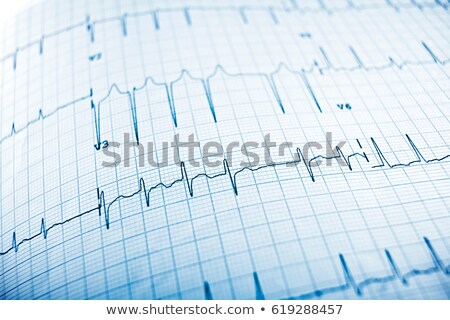 Electrocardiogram Close Up Сток-фото © pedrosala