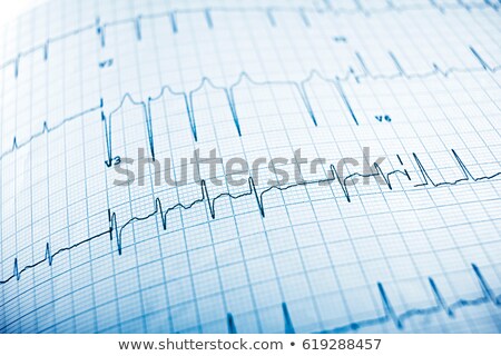 Electrocardiogram Close Up Foto d'archivio © pedrosala