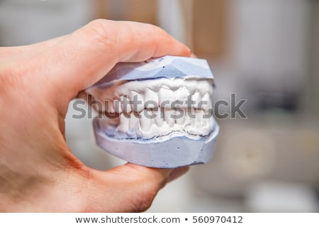 Stok fotoğraf: Dental Mould And Hand