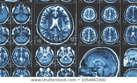 Zdjęcia stock: Human Brain And Magnet