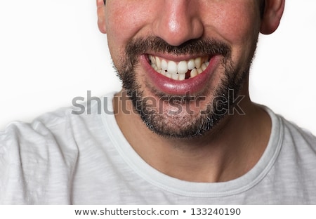Stockfoto: Man With Missing Teeth