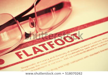 Foto stock: Flatfoot Diagnosis Medical Concept 3d Render