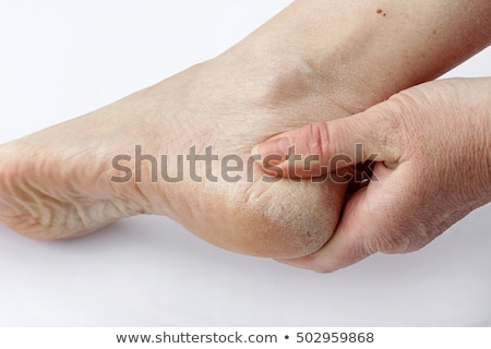 [[stock_photo]]: Bottom Of Her Feet