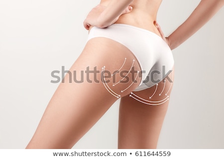 Stock photo: Female Body Correction Surgery Marks