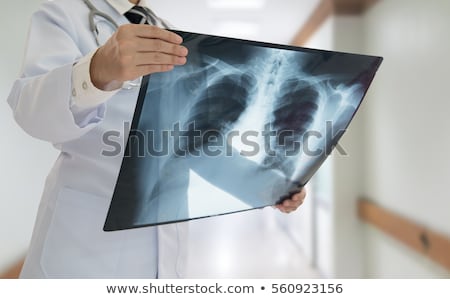 Stock fotó: Ellkas · röntgen