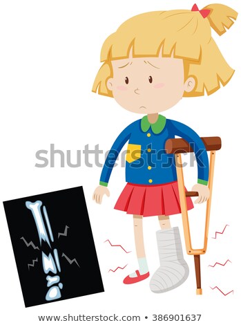 Stock photo: Girl With Broken Leg And X Ray Film