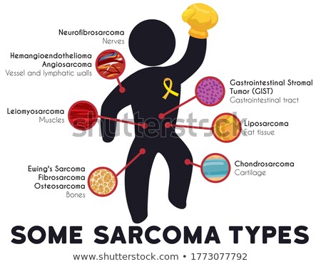 Stockfoto: Types Sarcoma