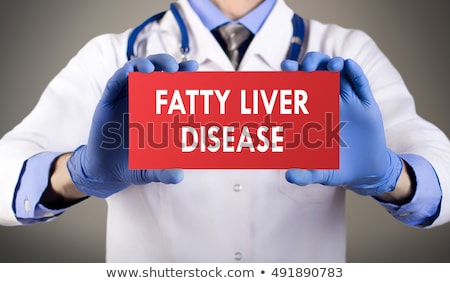 Stok fotoğraf: Fatty Liver Disease Diagnosis Medical Concept
