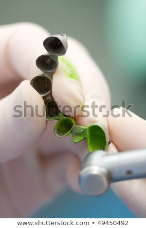 Foto d'archivio: A Dentist Detecting Fixing Premature Contacts Between The Toot And Denture With Occlusal Spray - S