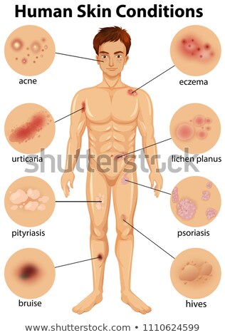 Stock photo: Various Human Skin Conditions