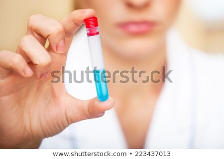 Stock fotó: Unhappy Young Scientist Holding Samples With Bad Testing Results