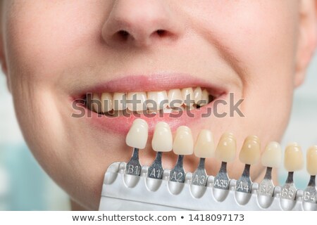 Stock photo: Shade Determination Tooth