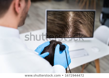 Foto stock: Dermatologist Using Trichoscope For Hair Fall Treatment
