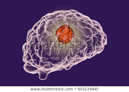 Stock foto: Brain Cancer