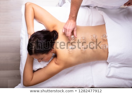 Foto d'archivio: Woman Receiving Cupping Treatment On Her Back