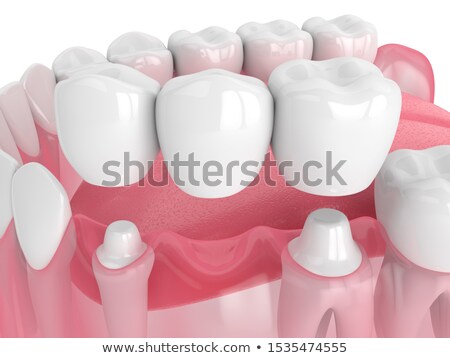 Stok fotoğraf: Artificial Tooth