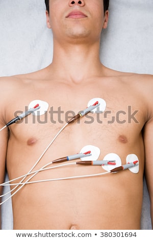 Foto stock: Young Man With Electrodes On Chest