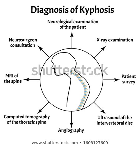 Stock photo: Kyphosis Diagnosis Medical Concept