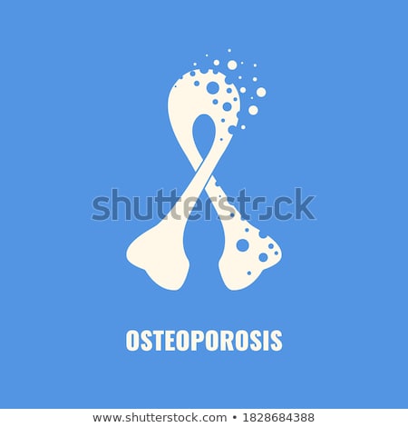 Zdjęcia stock: Human Osteoporosis