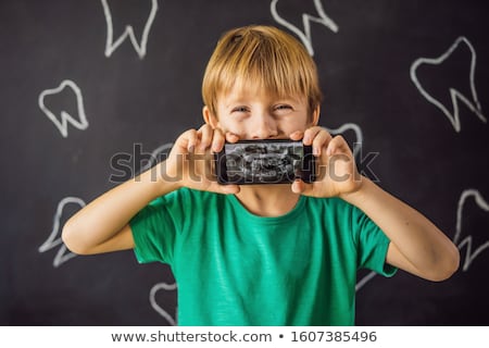 Zdjęcia stock: The Boy Shows His X Ray Image Of His Teeth With An Abnormally Strange Extra Tooth Childrens Dentis