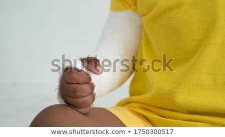 Foto stock: Boy With Broken Arm