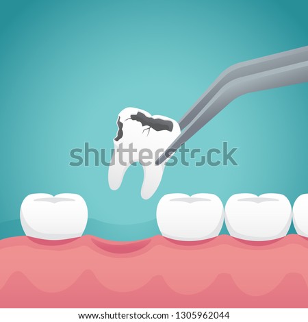 Сток-фото: Removes Tooth